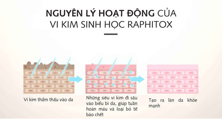 Nguyên lý hoạt động vi kim sinh học